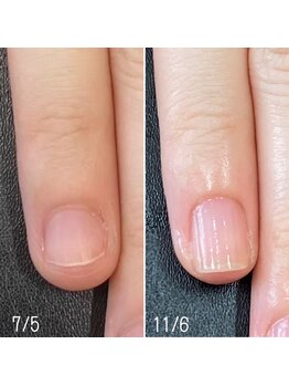 ネイルズ アヴァンティ(Nails Avanti)/自爪育成ケア3ヶ月コース