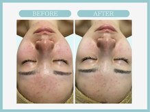 スリムライン 仙台店(The Slim Line)/before→after