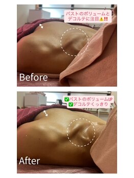 チュラ 大宮店(Chura)/【40代】魅せるデコルテ美人に!