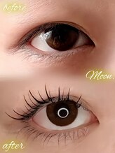 ムーン(Moon.)/エクパ100本