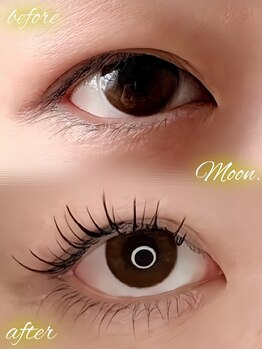 ムーン(Moon.)/エクパ100本