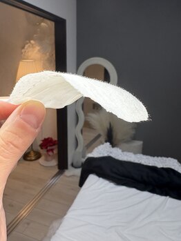 キスミー(Ksmiii)/フェイスワックス脱毛