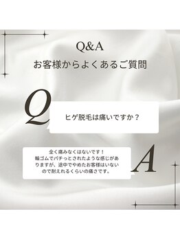 アイリス(IRIS)/よくある質問