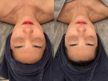 ポーデベロア(Peau des velours)/陶肌トリートメント