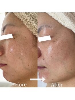 シェノン 赤坂大濠店/