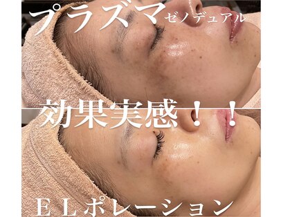 トータルエステティック ジョワイユ(JOYEUX)の写真