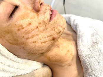 マキの写真/優雅な音楽と上品で落ち着いた素敵な空間☆お顔はもちろん、大人気のリンパマッサージで肩凝りもスッキリ♪