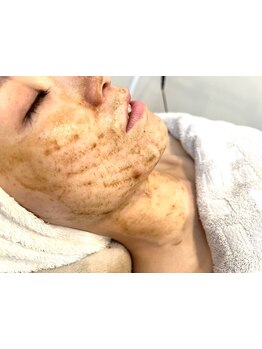 お肌をきれいにしたい