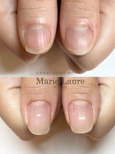 マリーロール 梅田店(Marie Laure)/深爪矯正/自爪育成/自爪風