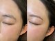 ビズム(BISM)の写真/お顔の第一印象を決める"眉"！骨格、筋肉、左右の高さの違いなどを細かく診断した上で理想の形に。