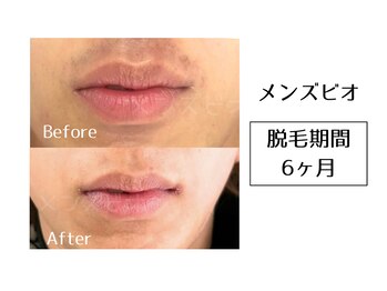 メンズビオ 神戸三宮店/