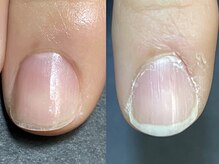 爪のお手入れサロン ＫＩＲＡＲＩＮＡＩＬの雰囲気（爪の周りがキレイになるだけで清潔感もUP）