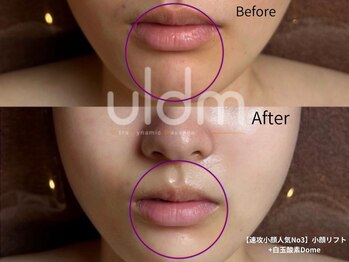 ミラ 中央林間(mira)/小顔　毛穴　ホワイトニング