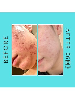 レヴィア 東大宮店(REVIA)/before/after