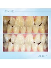 リラパドマ 千葉店(Rela Padma)/【ホワイトニング】