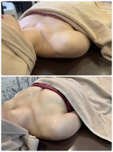 ロココ 天神店(Rococo)/バストアップ◇育乳症例◇