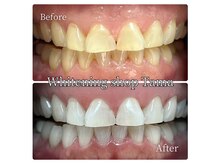 ホワイトニングショップ 多摩店/