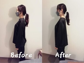 クーオス(KuuOs)/【20代/女性】1回の施術後変化