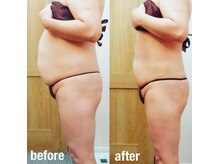 レイプラス 仙台店(RAY PLUS)/◆ビフォーアフター例のご紹介◆