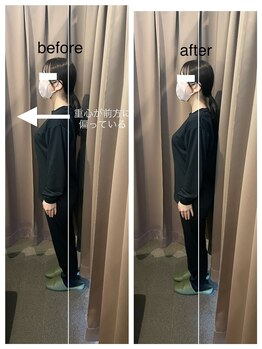 アイリー(Irie)/骨格矯正