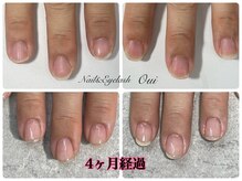 ウイ(Oui)/自爪育成