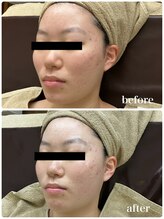 ジャスミン(Jasmin)/ホワイトニングフェイシャル