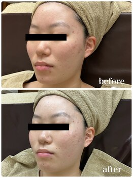 ジャスミン(Jasmin)/ホワイトニングフェイシャル