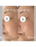 【根本改善のエイジングケア】再生フェイシャルフルコース ￥6600→