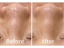 ラポール 野並店(Rapport)/