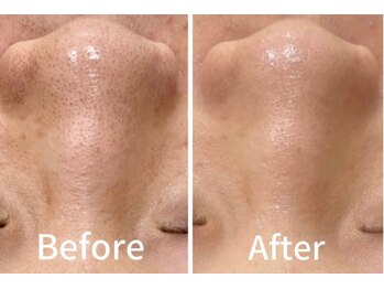 ラポール 野並店(Rapport)/