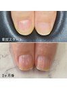 自爪育成ケア3ヶ月コース