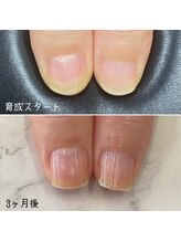 ネイルズ アヴァンティ(Nails Avanti)/自爪育成ケア3ヶ月コース