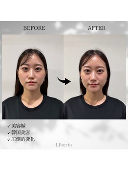 リベルタ鍼灸整骨院 なんば店(Liberta鍼灸整骨院)/ヘッドスパの重要性は?
