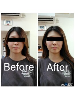 整体治療院 和の写真/小顔矯正でむくみや左右差を改善しスッキリとした印象へ導きます。結婚式や前撮り前にも人気◎