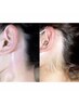 【360度美肌】プレミアム構造WAX（全顔＋顎下＋首＋うなじ）