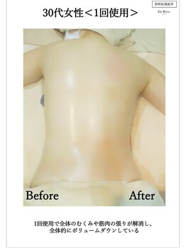 カナエル(QANAEL)/スリミングクリーム効果4