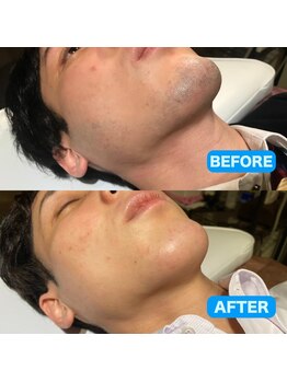 ビビ(Vi/Bi)/男性の身だしなみ★