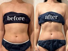 ビューティーサロン ラグジューム(Beauty salon Laxum)/腸活+筋膜リリース