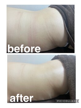 ギンザアール(GINZA R.)/腰痛回改善に！