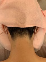 ゼン リラクゼーション 新宿店(Zen Relaxation)/うなじスッキリ脱毛