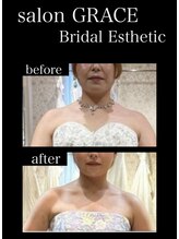 サロン グレイス(salon GRACE)/