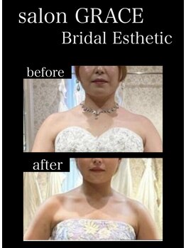 サロン グレイス(salon GRACE)/