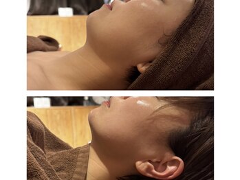 ナッティ(natti)/小顔リフトアップ