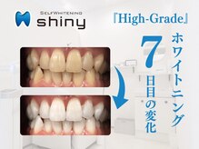 ホワイトニングサロン シャイニー 浜松細島店(shiny)/【超絶・美・白】ホワイトニング