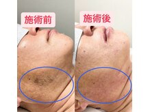 オーキ 横浜(Orchi)/黒髭も白髪髭も