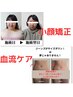 小顔矯正＋体の歪み、冷え、むくみケア　12,000円→4,400円　90分