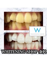 ホワイトニング ショップ 金沢店/第一印象をもっと素敵に！！