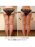 【美脚コース】セル脂肪を徹底分解!下半身痩せはコレ!¥11000→¥6800