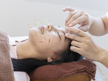 たまプラ治療院の写真/【国家資格者による本格美容鍼30分¥7700】新陳代謝を活性化することで顔のむくみを取ります!