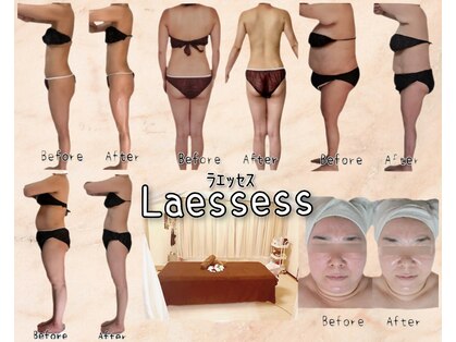 ラエッセス(A Laessess)の写真